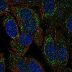 Invitrogen HARS2 Polyclonal Antibody 100 &mu;L; Unconjugated:Antibodies,