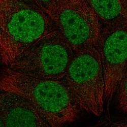 Invitrogen CBX6 Polyclonal Antibody 100 &mu;L | Buy Online | Invitrogen&trade; | Fisher Scientific