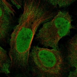 Invitrogen NF1 Polyclonal Antibody 100 &mu;L; Unconjugated:Antibodies,