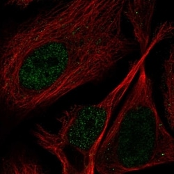 Invitrogen PPP1R3F Polyclonal Antibody 100 &mu;L; Unconjugated:Antibodies,