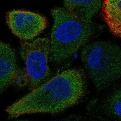 Invitrogen FAM83E Polyclonal Antibody 100 &mu;L; Unconjugated:Antibodies,