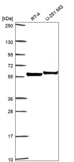 Invitrogen Apolipoprotein J Polyclonal Antibody 100 &mu;L; Unconjugated:Antibodies,