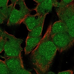 Invitrogen TBX10 Polyclonal Antibody 100 &mu;L; Unconjugated:Antibodies,
