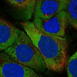 Invitrogen ZNF385A Polyclonal Antibody 100 &mu;L; Unconjugated:Antibodies,