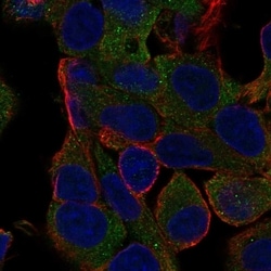 Invitrogen MOGAT1 Polyclonal Antibody 100 &mu;L; Unconjugated:Antibodies,