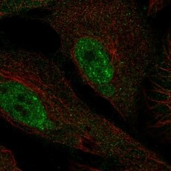 Invitrogen PHF1 Polyclonal Antibody 100 &mu;L; Unconjugated:Antibodies,