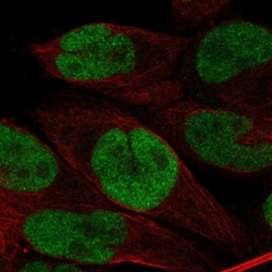Invitrogen BRD3 Polyclonal Antibody 100 &mu;L; Unconjugated:Antibodies,