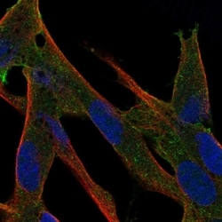Invitrogen LRCH2 Polyclonal Antibody 100 &mu;L; Unconjugated:Antibodies,