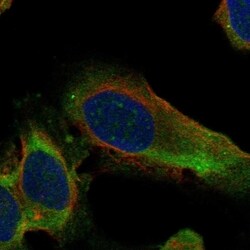 Invitrogen RPL10A Polyclonal Antibody 100 &mu;L; Unconjugated:Antibodies,