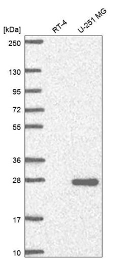 Invitrogen NCCRP1 Polyclonal Antibody 100 &mu;L | Buy Online | Invitrogen&trade; | Fisher Scientific
