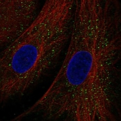 Invitrogen TEX36 Polyclonal Antibody 100 &mu;L; Unconjugated:Antibodies,