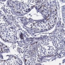 Invitrogen SPPL2C Polyclonal Antibody 100 &mu;L; Unconjugated:Antibodies,