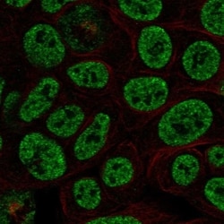 Invitrogen PIAS2 Polyclonal Antibody 100 &mu;L; Unconjugated:Antibodies,