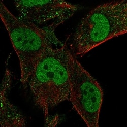 Invitrogen MLIP Polyclonal Antibody 100 &mu;L; Unconjugated:Antibodies,