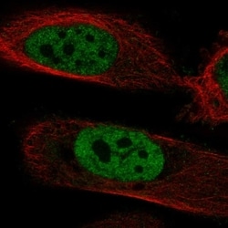 Invitrogen POLM Polyclonal Antibody 100 &mu;L; Unconjugated:Antibodies,