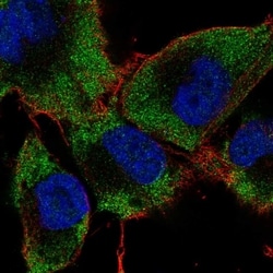 Invitrogen RAB24 Polyclonal Antibody 100 &mu;L; Unconjugated:Antibodies,