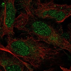 Invitrogen PRPF39 Polyclonal Antibody 100 &mu;L; Unconjugated:Antibodies,