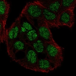 Invitrogen C2CD4A Polyclonal Antibody 100 &mu;L; Unconjugated:Antibodies,