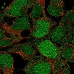 Invitrogen USP26 Polyclonal Antibody 100 &mu;L; Unconjugated:Antibodies,