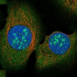 Invitrogen RAD51AP2 Polyclonal Antibody 100 &mu;L; Unconjugated:Antibodies,