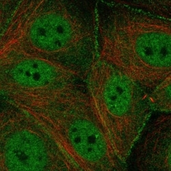 Invitrogen TMPRSS13 Polyclonal Antibody 100 &mu;L; Unconjugated:Antibodies,