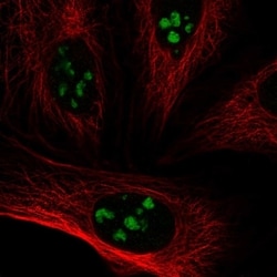 Invitrogen VSX1 Polyclonal Antibody 100 &mu;L; Unconjugated:Antibodies,