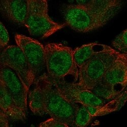 Invitrogen METTL3 Polyclonal Antibody 100 &mu;L; Unconjugated:Antibodies,