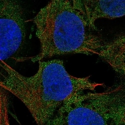 Invitrogen HRASLS5 Polyclonal Antibody 100 &mu;L; Unconjugated:Antibodies,