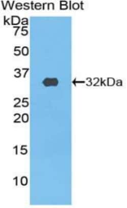 Invitrogen PIK3C2B Polyclonal Antibody, Invitrogen 20 &mu;L; Unconjugated:Antibodies,
