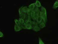 Invitrogen beta Tubulin Polyclonal Antibody, Invitrogen 20 &mu;L; Unconjugated:Antibodies,