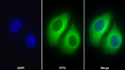 Invitrogen beta Tubulin Polyclonal Antibody, Invitrogen 200 &mu;L; Unconjugated:Antibodies,