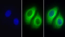 Invitrogen beta Tubulin Polyclonal Antibody, Invitrogen 200 &mu;L; Unconjugated:Antibodies,