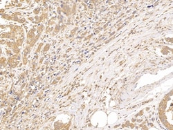 Invitrogen beta Tubulin Polyclonal Antibody, Invitrogen 20 &mu;L; Unconjugated:Antibodies,