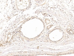 Invitrogen beta Tubulin Polyclonal Antibody, Invitrogen 200 &mu;L; Unconjugated:Antibodies,