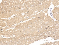 Invitrogen beta Tubulin Polyclonal Antibody, Invitrogen 200 &mu;L; Unconjugated:Antibodies,