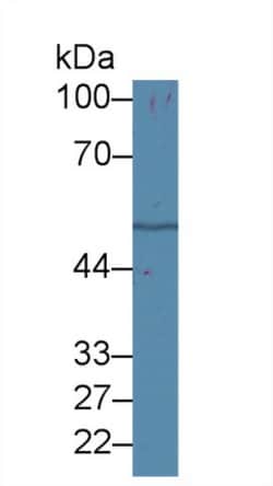 Invitrogen beta Tubulin Polyclonal Antibody, Invitrogen 20 &mu;L; Unconjugated:Antibodies,