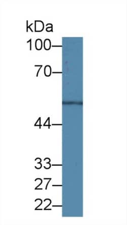 Invitrogen beta Tubulin Polyclonal Antibody, Invitrogen 200 &mu;L; Unconjugated:Antibodies,