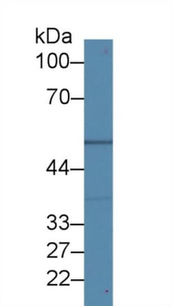 Invitrogen beta Tubulin Polyclonal Antibody, Invitrogen 20 &mu;L; Unconjugated:Antibodies,