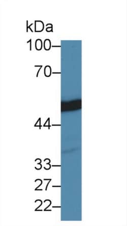 Invitrogen beta Tubulin Polyclonal Antibody, Invitrogen 20 &mu;L; Unconjugated:Antibodies,