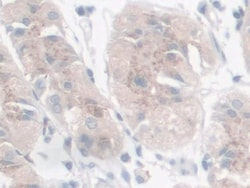 Invitrogen Galectin 9 Polyclonal Antibody, Invitrogen 20 &mu;L; Unconjugated:Antibodies,