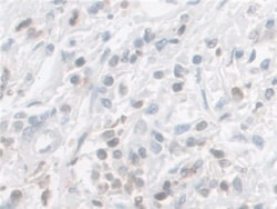 Invitrogen Galectin 9 Polyclonal Antibody, Invitrogen 20 &mu;L; Unconjugated:Antibodies,
