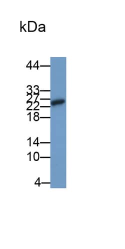 Invitrogen Galectin 9 Polyclonal Antibody, Invitrogen 20 &mu;L; Unconjugated:Antibodies,