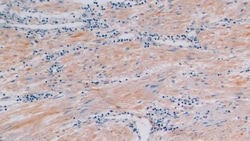 Procollagen I C-Peptide Polyclonal Antibody, Invitrogen:Antibodies:Primary