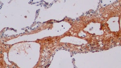 Procollagen I C-Peptide Polyclonal Antibody, Invitrogen:Antibodies:Primary