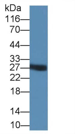 Trypsin Polyclonal Antibody, Invitrogen:Antibodies:Primary Antibodies