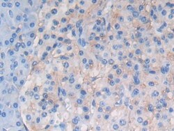 ATF6 Polyclonal Antibody, Invitrogen:Antibodies:Primary Antibodies