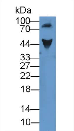Invitrogen ORM1 Polyclonal Antibody, Invitrogen 20 &mu;L; Unconjugated:Antibodies,