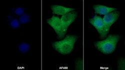Invitrogen S100A4 Polyclonal Antibody, Invitrogen 20 &mu;L; Unconjugated:Antikroppar