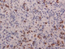 Invitrogen S100A4 Polyclonal Antibody, Invitrogen 20 &mu;L; Unconjugated:Antibodies,