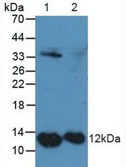 Invitrogen S100A4 Polyclonal Antibody, Invitrogen 20 &mu;L; Unconjugated:Antibodies,